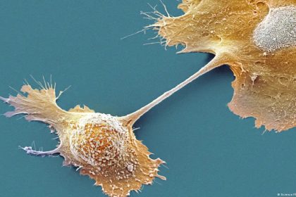 Pildora-promete-cambiar-el-panorama-del-cancer-pancreatico